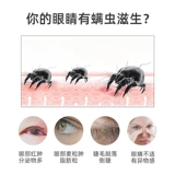 Будьте осторожны с удалением глаз клещей и влажных полотенец, специальным маслом чайного дерева, сосновое масло, глазные веки, чистое глазное пластырь для век.