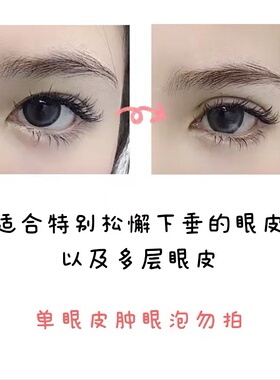 韩吻眼皮松弛多重眼皮防下垂眼贴