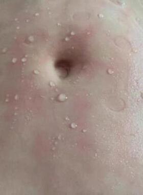 超长波瘦身瘦肚子神器美容院热敷震脂减小腹减脂肪震动加热腰带