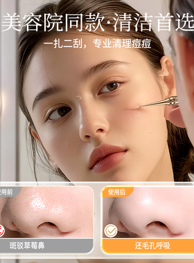 德国超尖细粉刺针黑头针美容院专用套装挤痘痘工具刮闭口暗疮针