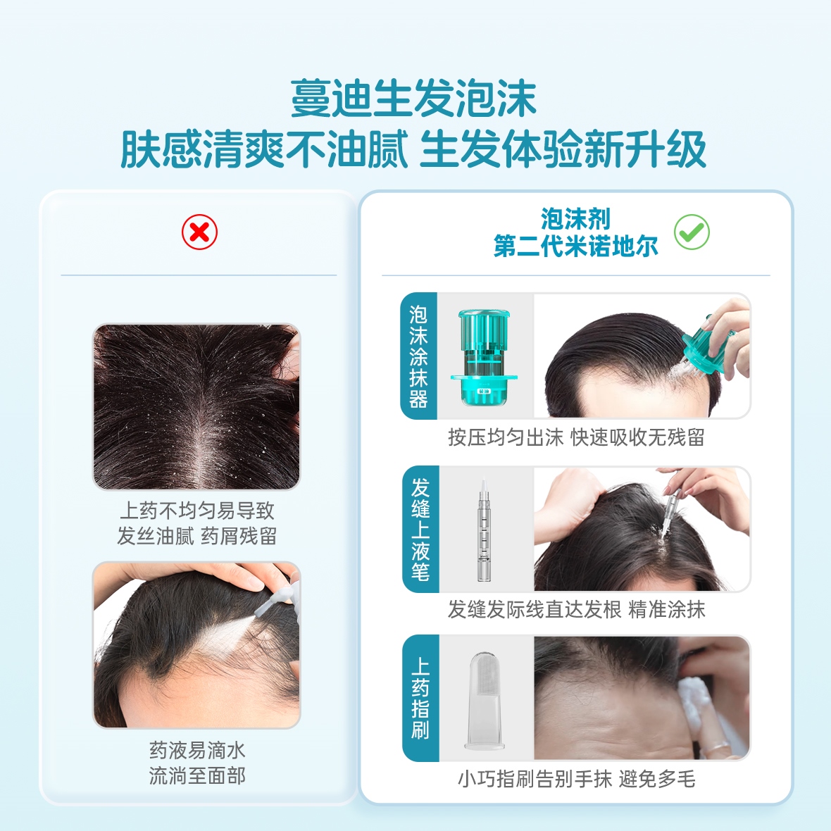第二代米诺地尔蔓迪生发泡沫剂男女性防脱生发增发非液官方旗舰店
