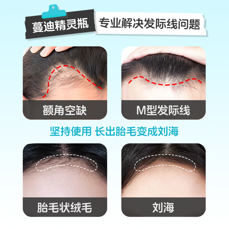 发际线专属蔓迪生发精灵瓶米诺地尔酊上药器男女防脱发增长液精华