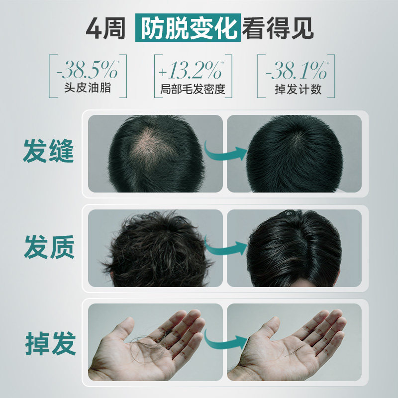 【女士防脱专属】蔓迪女士防脱洗发水乌诺地尔强韧发根固发养育发