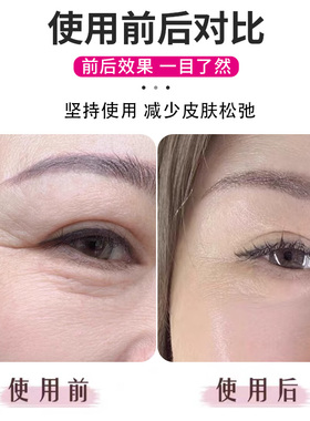 眼袋舒缓贴提拉紧肤眼贴自剪提拉贴鱼尾纹贴眼皱纹贴淡纹消除神器