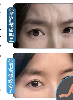 川字纹眉间贴法令纹贴