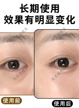 卧蚕固定贴泪袋贴双眼皮贴拉线细长型加宽型妈生卧蚕我get到了！