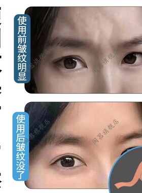 防止皱眉头神器川字纹贴眉间贴睡觉上班防皱眉神器皱眉矫正贴