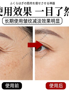 去眼角鱼尾纹神器男女士抗皱纹消除眼霜去眼纹眼袋细纹提拉紧致贴