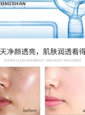 素颜灯泡肌五件套 打造素颜灯泡肌肤 补水保湿美容院线下套盒
