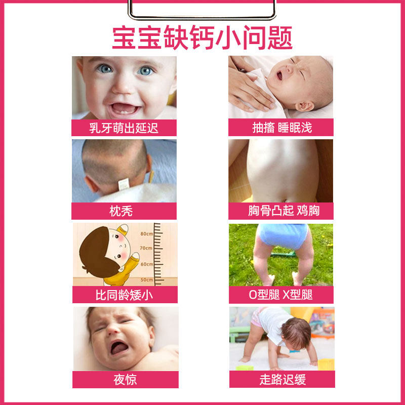 蜜牙贝贝钙铁锌