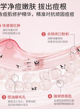 壬二酸凝胶净颜凝露祛痘淡化痘印