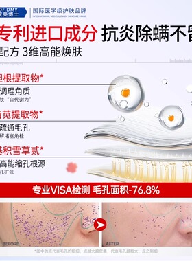 硫磺洗面奶油痘肌控油除螨去痘