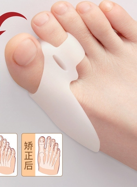 拇指外翻脚趾矫正器男女士硅胶大拇指专用分趾器神器可穿鞋