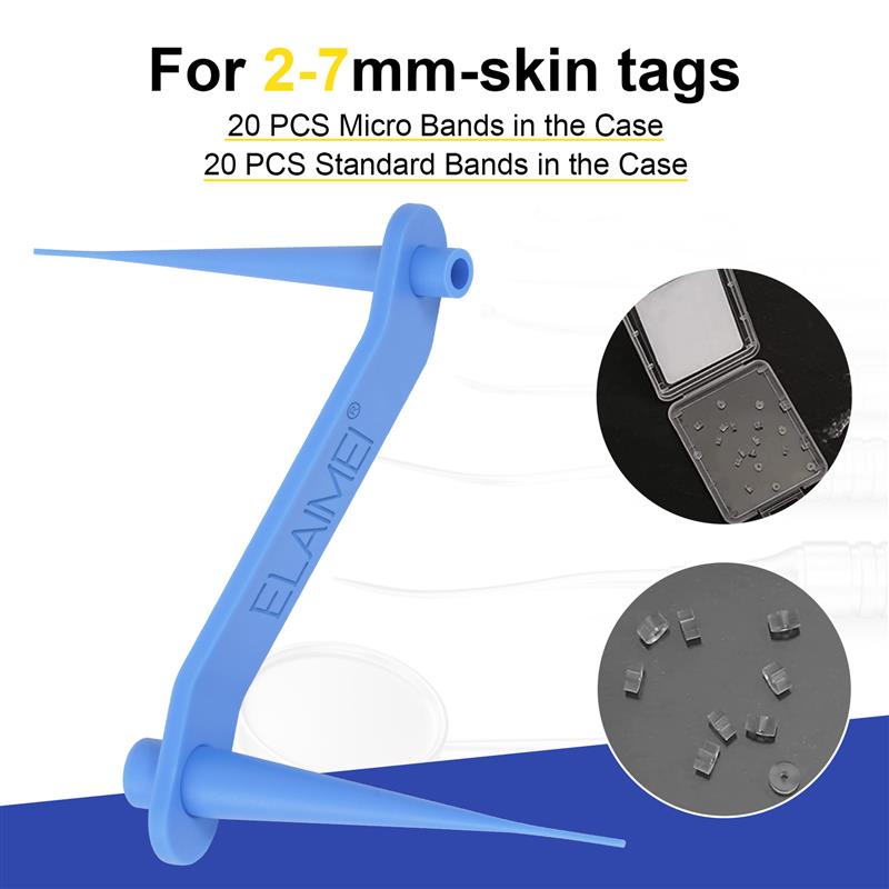 Skin Tag Remover Device for Large Skin Tags祛疣工具平跖去除-图0