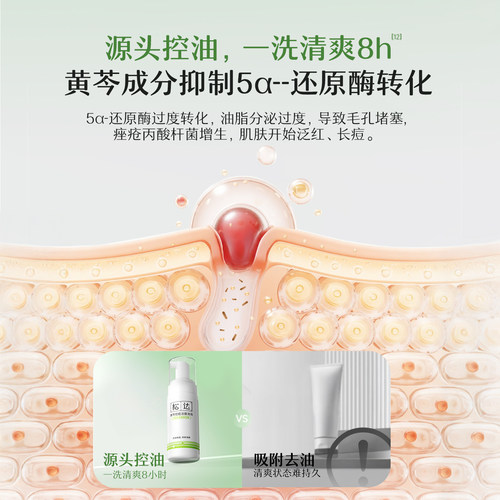 松达青少年黄芩控痘洁面泡泡祛痘护肤洁面乳洗脸控油氨基酸洗面奶 - 图0