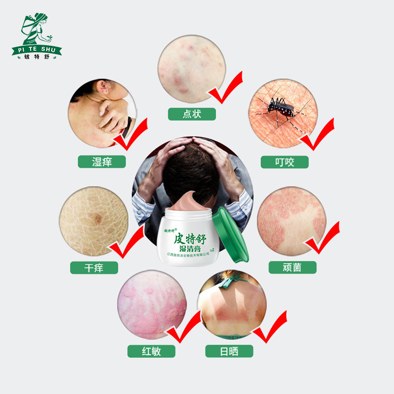 湿痒皮肤瘙痒外用私处成人湿清膏 碧缇福医疗器械皮肤消毒护理（消）