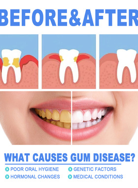 Tooth Repair Gel Repair Gum Swelling And Pain Deep Cleaning
