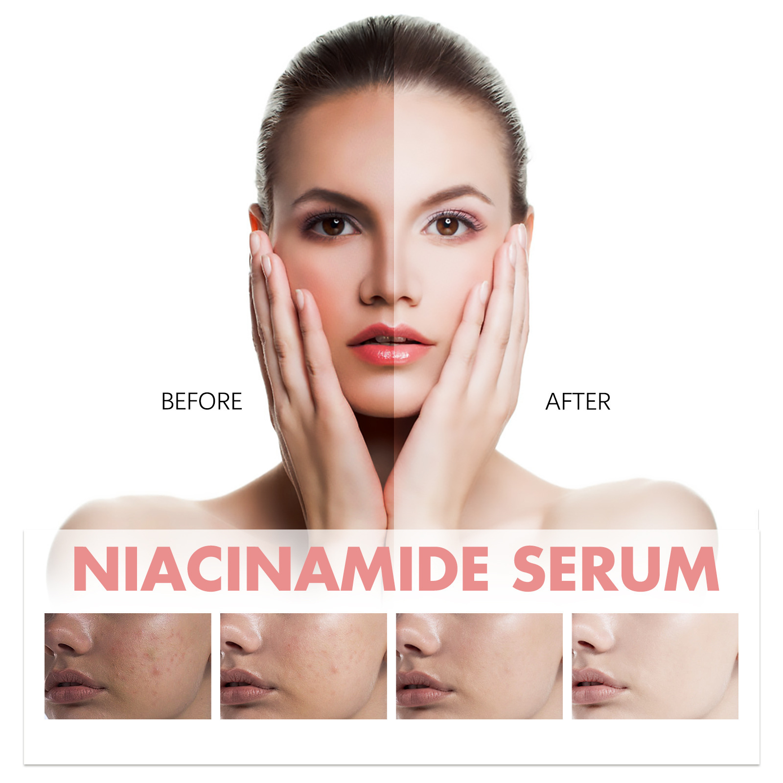 Hoygi Niacinamide Essence Firming And Moisturizing Pore - 图1