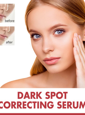 Hoygi Black Spot Repair Essence Lightens Skin Dark Spots