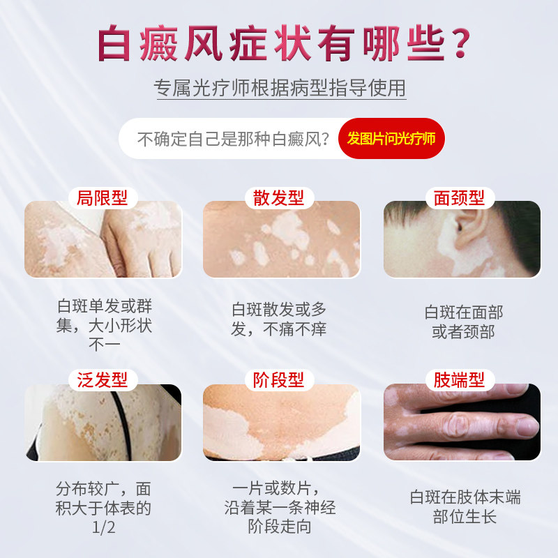 科诺家用大面积白癜风光疗仪银屑病 活沃医疗器械理疗仪（器械）