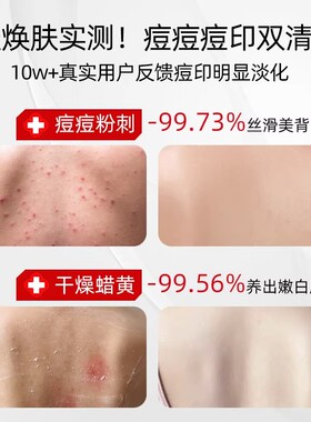 【三甲同款】前胸后背祛痘喷雾