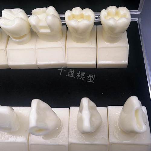 牙科4倍大窝洞制备模型四倍牙齿备牙标准示范嵌体洞R型12个M7025 - 图2