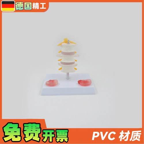 德国】PNT0131三节腰椎带病变椎间盘病变椎间盘骨骼X模型骨科疼痛 - 图1