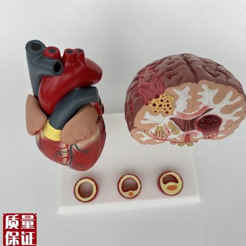 人体心脑血管展示模型血压高心脏模具L与心血管模型对比教具模 - 图2