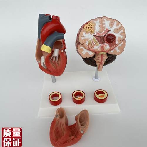 人体心脑血管展示模型血压高心脏模具L与心血管模型对比教具模 - 图0