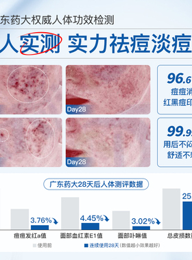 祛痘淡化痘印痘坑舒缓控油套装