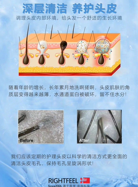 正品柔弗头皮毛囊洁净保护液洁净护理液清洁液油脂舒缓头痒头屑