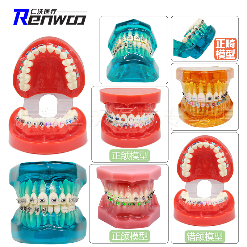 牙科牙齿模型口腔教学儿童牙模型齿科教具正畸种植牙医患沟通模型 - 图2