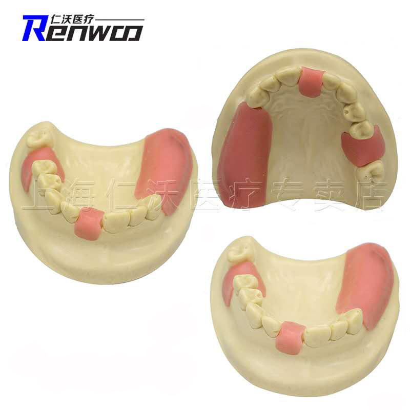 口腔种植练习模型 半口 全口 种植模型 模具 种植体 牙科种植模型 - 图2