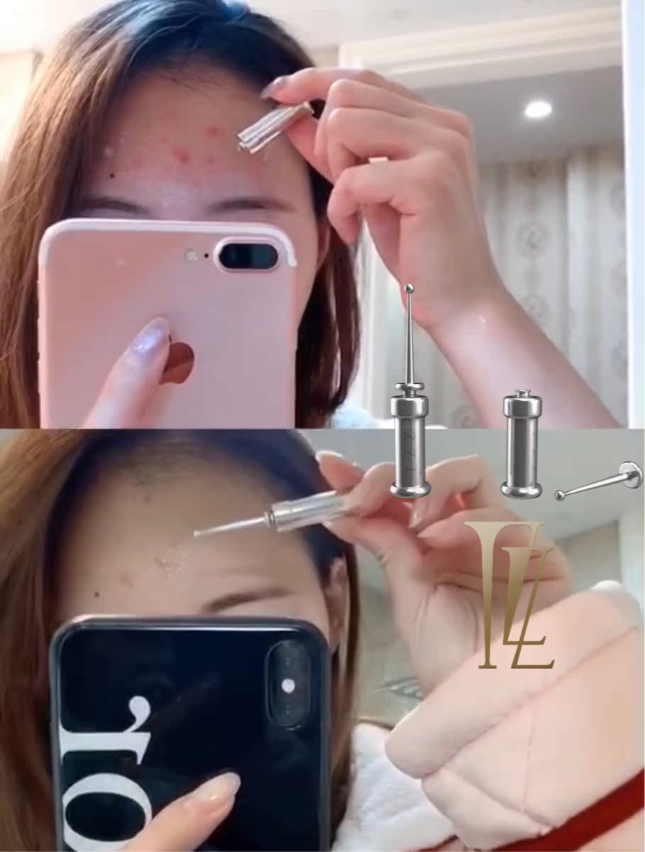 急救祛痘嫩肤提拉面部紧致减少细纹收缩毛孔 缇芝安瓶精华原液 TZZ 急救祛痘嫩肤提拉面部紧致减少细纹收缩毛孔 缇芝安瓶精华原液 TZZ