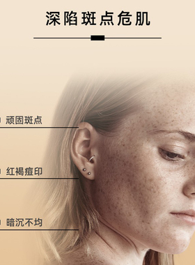 高阶狠货美白淡斑贝雅欧若拉安瓶
