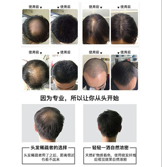 The hair fiber that makes sparse hair thicker quickly