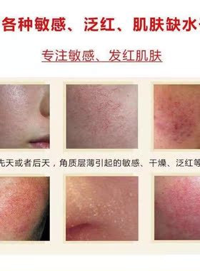 自然乐园芦荟胶消炎去红舒缓抗敏