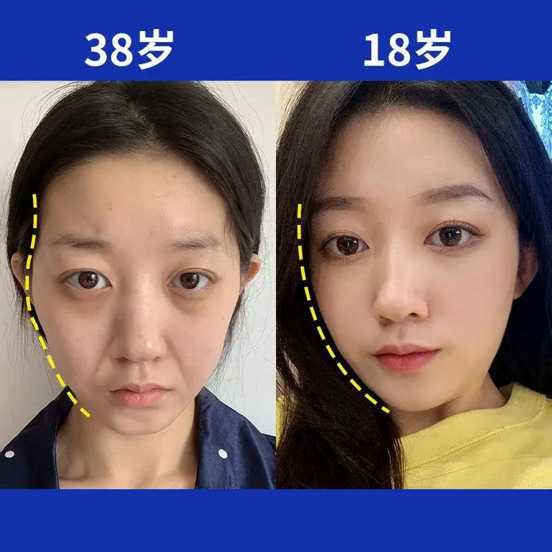 佰草世家丰脸精油填充脸部凹陷太阳穴泪沟法令纹脸颊丰脸精华液_虎窝淘