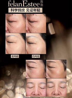临期清 面霜27年5月 水乳26年4月斯勤多肽面霜 精粹水乳 活性肽