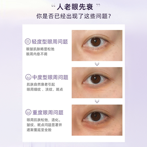 CMM郑明明波尔多修纹紧致眼霜保湿抗皱紧致改善细纹官方旗舰正品 - 图2