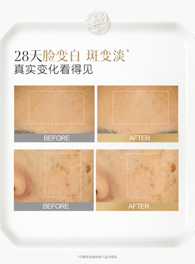 佰草集新七白三明治大白泥套装