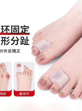 拇指外翻脚趾重叠矫正器日夜两用