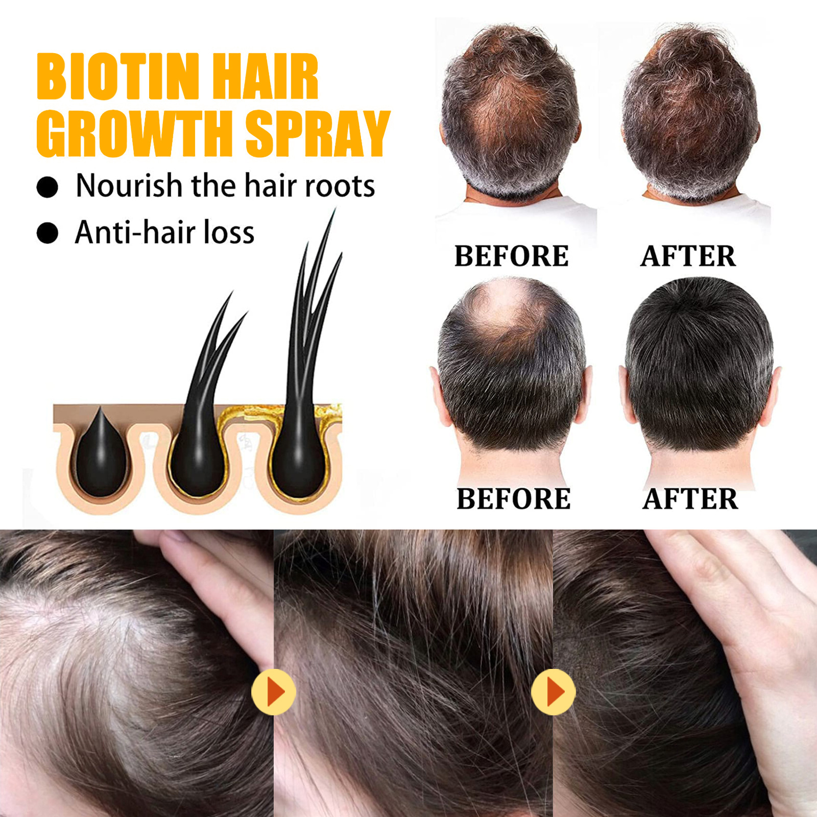 Ginger Hair Fast Growth Serum Spray Biotin Anti Hair Loss - 图2