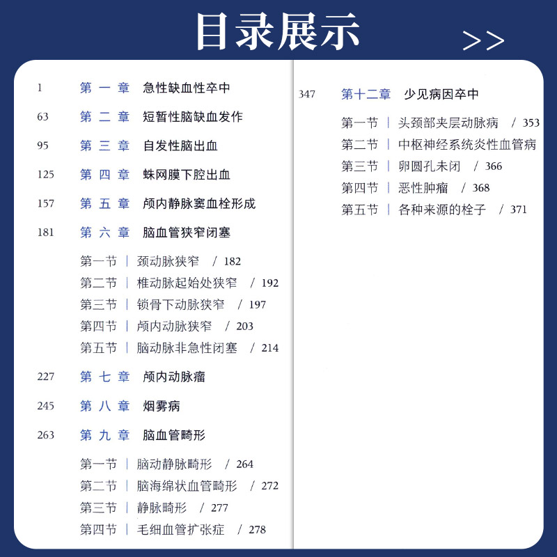 北京天坛医院神经医学临床工作手册 脑血管病 王硕 人民卫生出版社 供从事神经系统疾病诊疗 教学及研究工作的神经内科等人员参考 - 图1