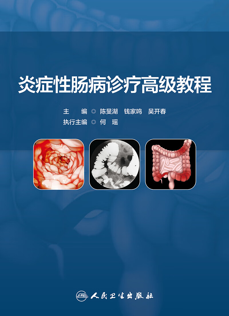 炎症性肠病诊疗 教程 陈旻湖 人民卫生出版社 流行病学 溃疡性结肠炎 克罗恩病的规范化诊断 肠道溃疡的鉴别诊断 IBD外科治疗