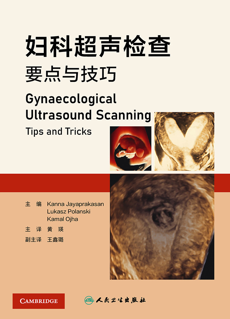 妇科超声检查要点与技巧 黄瑛 人民卫生出版社 妇科超声先进技术超声设备报告书写 超声扫查技术疾病诊断 影像学 妇产科学