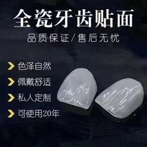 National set to make full porcelain veneered patch beauty tooth full porcelain patch Maryland Bridge Yiwon Garalan porcelain special sale