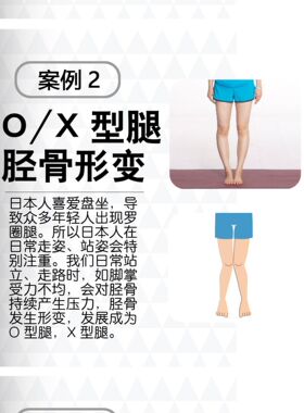 日本扁平足鞋垫xo女男足弓支撑