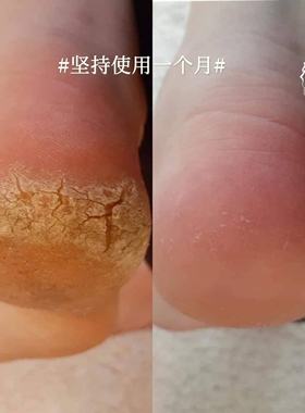 拥有嫩嫩脚后跟仙女爱用温和不伤肤去角质双面纳米玻璃搓脚板水洗