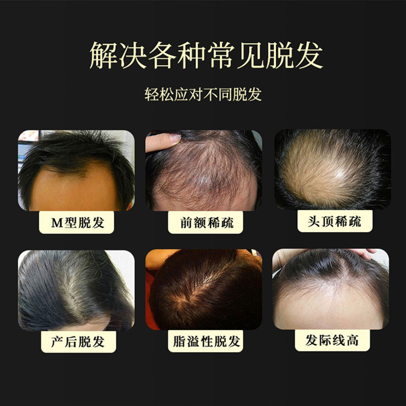 【3瓶】集兰集蔓浓乌发育发液男女防脱发际线植物护发液强根发质